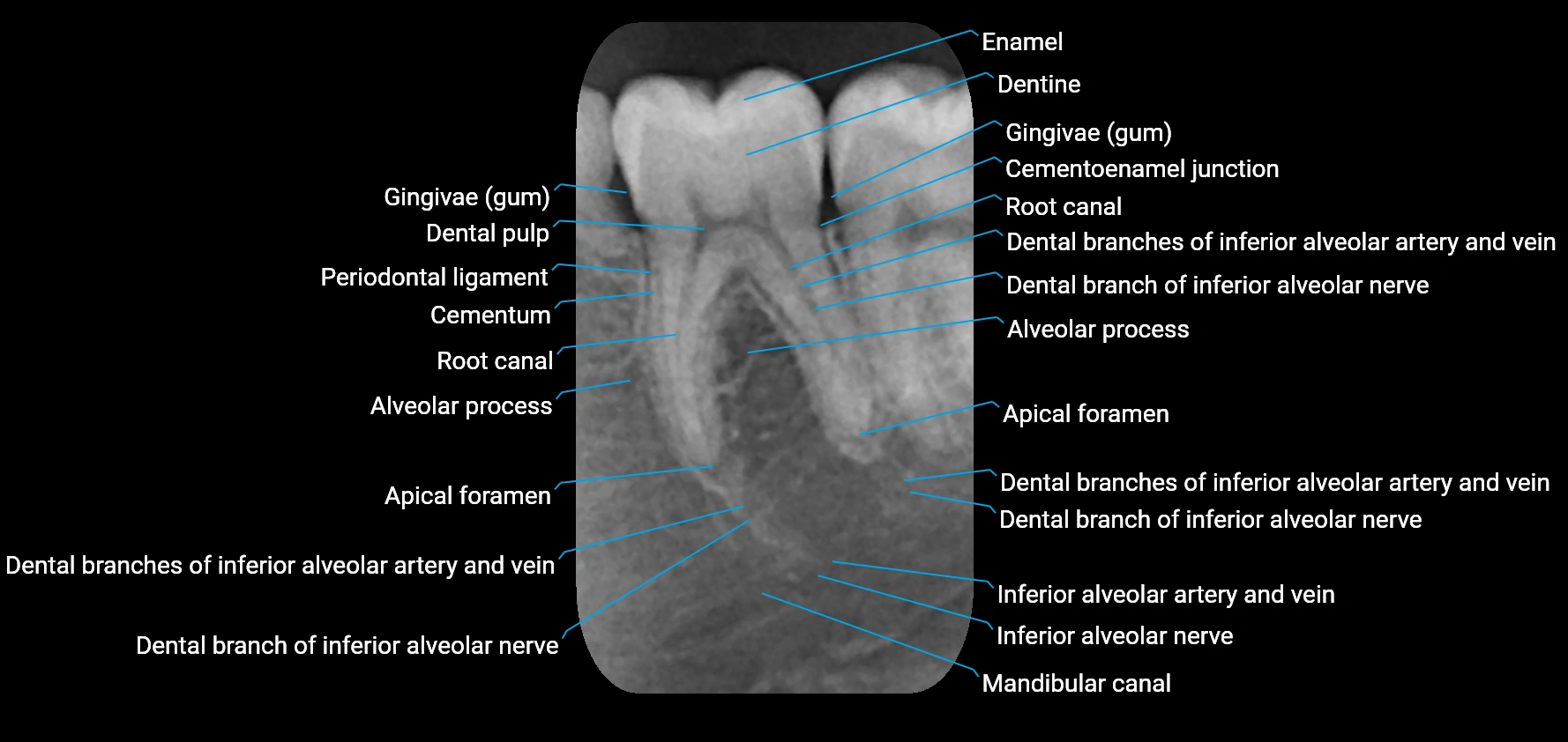 X ray Dental anatomy labelled image 1.webp